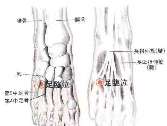 足临泣 李氏砭法 | 深探足临泣的神奇功效（上）