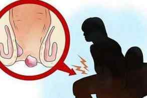 肛门胀痛 肛门疼痛非常危险！你了解怎么回事吗？