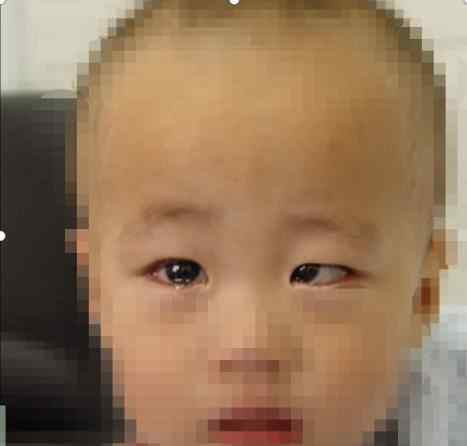 婴儿对眼多大消失 为什么宝宝的眼睛看起来像斗鸡眼，儿科医生却说不用担心？