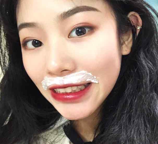 女生长小胡子原因 女生长出“小胡子”？离不开这3种“原因”，别再不当回事！