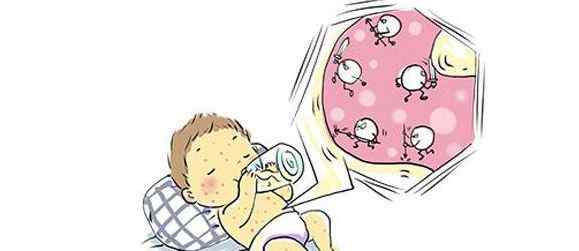 儿童干性湿疹图片 儿童得了“干性湿疹”怎么办？