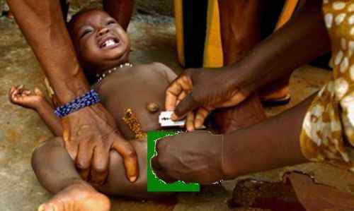 割礼图片 非洲残忍割礼女人后的图片，非洲为什么这么落后原因分析