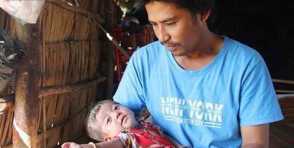 无肛症 越南8个月大孩子天生患无肛症，受尽疾病折磨，外表憔悴如老头