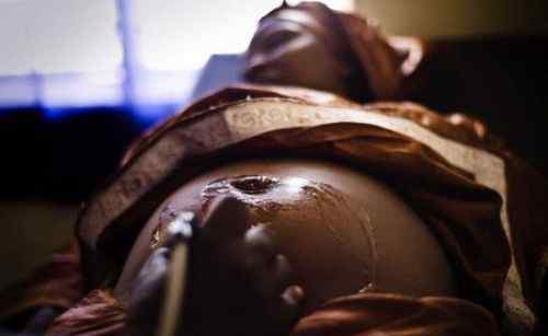 割礼图片 非洲残忍割礼女人后的图片，非洲为什么这么落后原因分析
