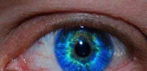 人快死时瞳孔图片 人类5种罕见的瞳孔