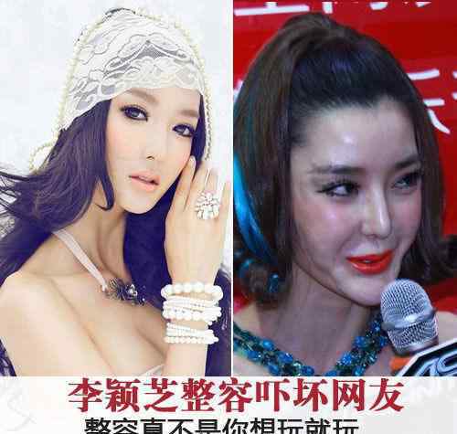 韩国整容 韩国女人整容老了以后变啥样？韩国整容是不是很便宜