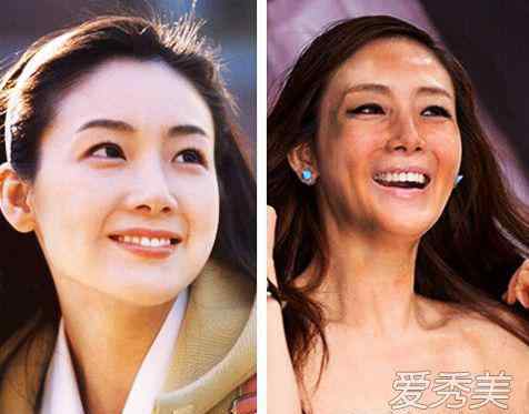 韩国整容 韩国女人整容老了以后变啥样？韩国整容是不是很便宜