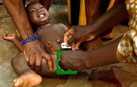 索马里割礼 非洲女孩割礼无遮掩图，割礼现在还有吗？非洲女孩割礼无遮掩图，割礼现在还有吗？
