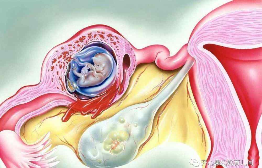 怀孕初期晚上身体燥热 孕早期担心生化？若出现这4个征兆，代表受精卵着床，恭喜了！