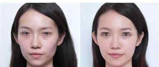 立秀膨体丰太阳穴，旺桃花撩汉子必备技能
