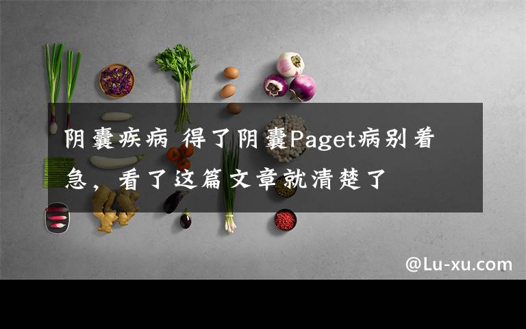 阴囊疾病 得了阴囊Paget病别着急，看了这篇文章就清楚了