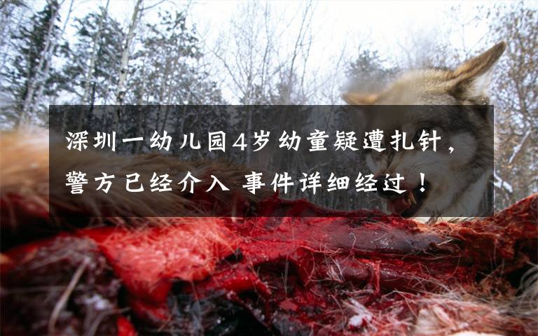深圳一幼儿园4岁幼童疑遭扎针，警方已经介入 事件详细经过！