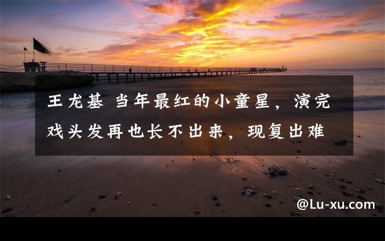 王龙基 当年最红的小童星，演完戏头发再也长不出来，现复出难演主角
