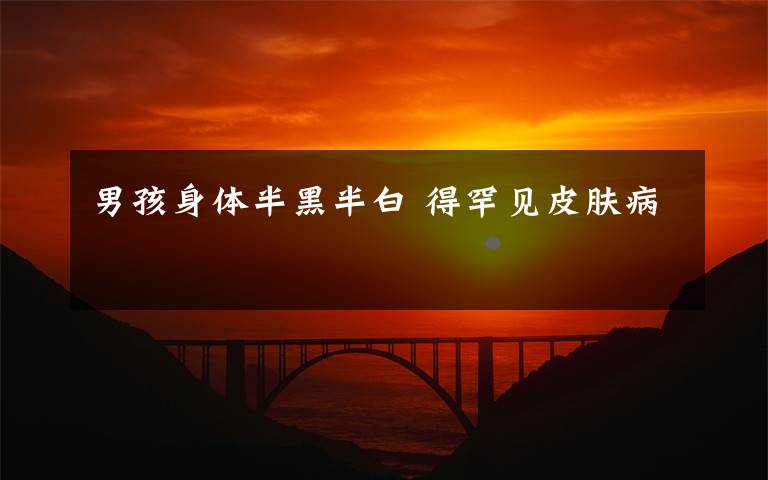 男孩身体半黑半白 得罕见皮肤病