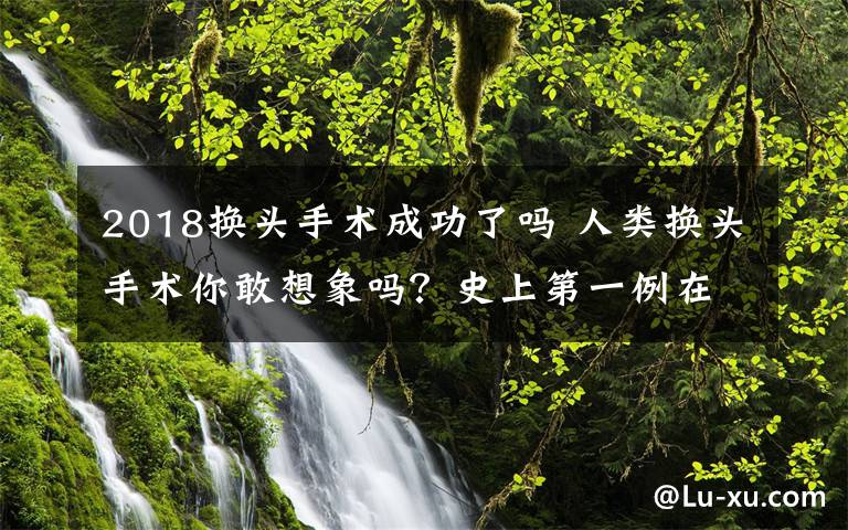 2018换头手术成功了吗 人类换头手术你敢想象吗？史上第一例在中国成功！