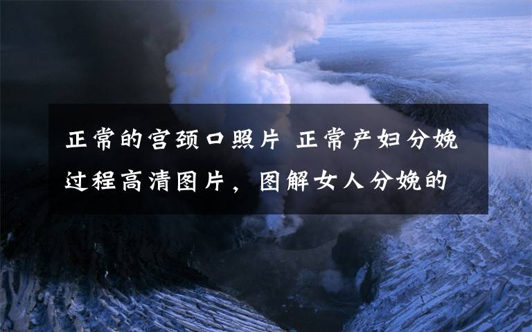 正常的宫颈口照片 正常产妇分娩过程高清图片，图解女人分娩的一些主要姿势