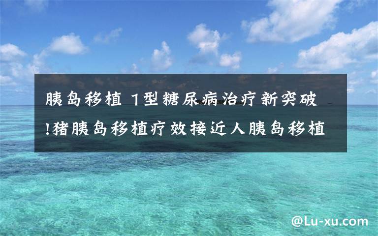 胰岛移植 1型糖尿病治疗新突破!猪胰岛移植疗效接近人胰岛移植