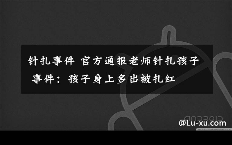 针扎事件 官方通报老师针扎孩子 事件：孩子身上多出被扎红