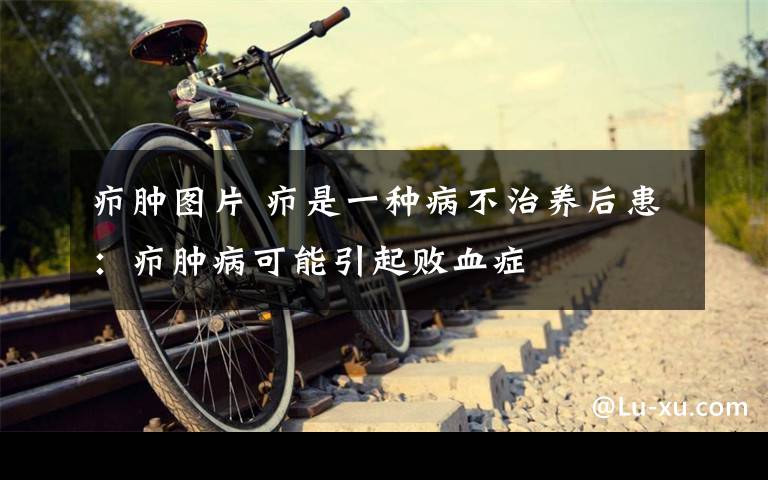 疖肿图片 疖是一种病不治养后患：疖肿病可能引起败血症
