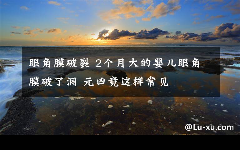 眼角膜破裂 2个月大的婴儿眼角膜破了洞 元凶竟这样常见