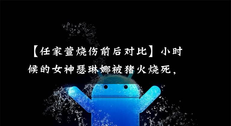 【任家萱烧伤前后对比】小时候的女神瑟琳娜被猪火烧死，在现场流泪，事故后参加马拉松，果断地展示了伤疤。