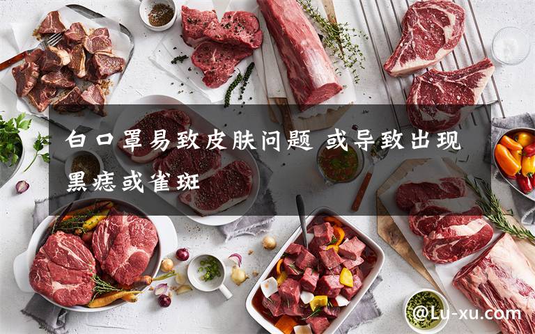 白口罩易致皮肤问题 或导致出现黑痣或雀斑