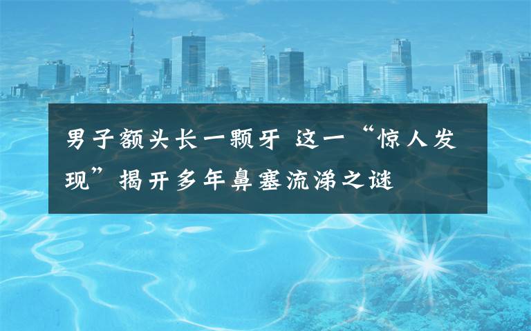 男子额头长一颗牙 这一“惊人发现”揭开多年鼻塞流涕之谜