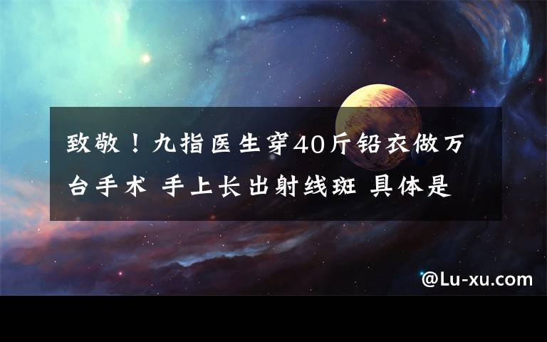 致敬！九指医生穿40斤铅衣做万台手术 手上长出射线斑 具体是啥情况?