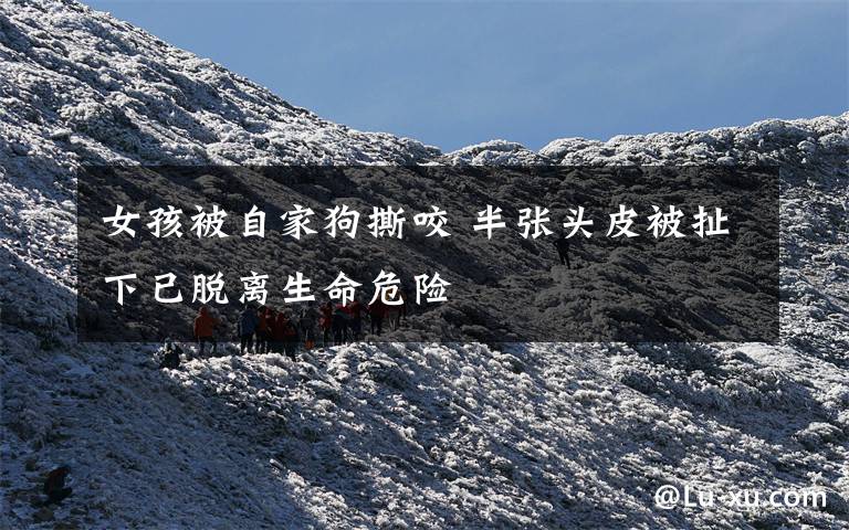 女孩被自家狗撕咬 半张头皮被扯下已脱离生命危险