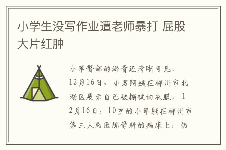 小学生没写作业遭老师暴打 屁股大片红肿