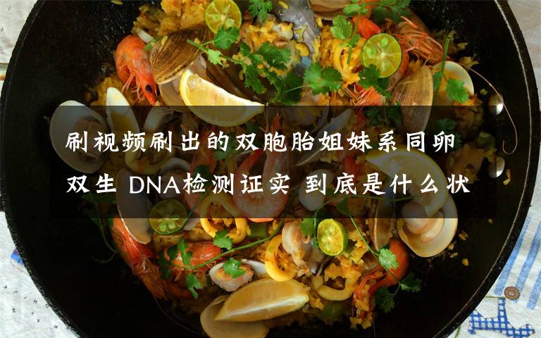 刷视频刷出的双胞胎姐妹系同卵双生 DNA检测证实 到底是什么状况？