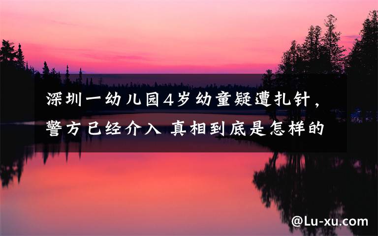 深圳一幼儿园4岁幼童疑遭扎针，警方已经介入 真相到底是怎样的？