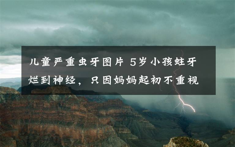 儿童严重虫牙图片 5岁小孩蛀牙烂到神经，只因妈妈起初不重视