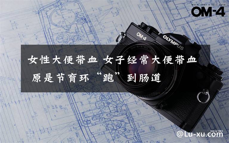 女性大便带血 女子经常大便带血 原是节育环“跑”到肠道