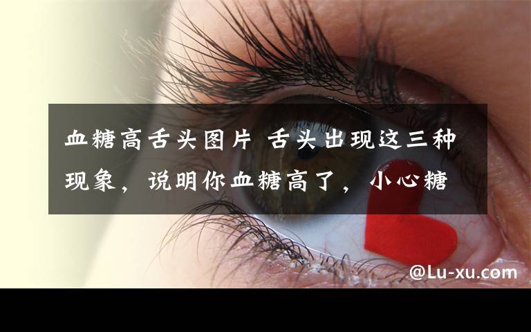 血糖高舌头图片 舌头出现这三种现象，说明你血糖高了，小心糖尿病早上门！