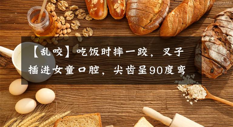 【乱咬】吃饭时摔一跤，叉子插进女童口腔，尖齿呈90度弯曲，医生精细手术将其取出
