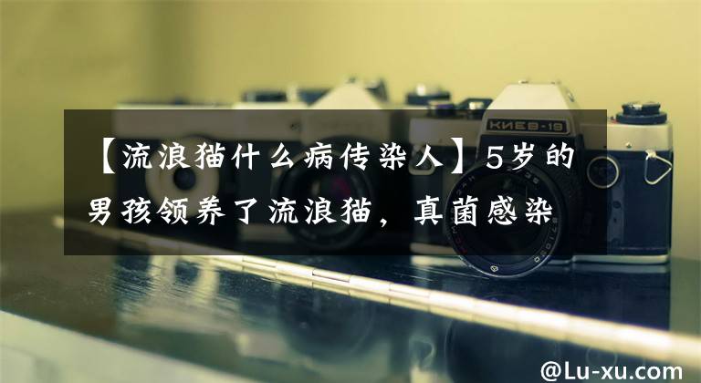 【流浪猫什么病传染人】5岁的男孩领养了流浪猫，真菌感染了“腹泻头”