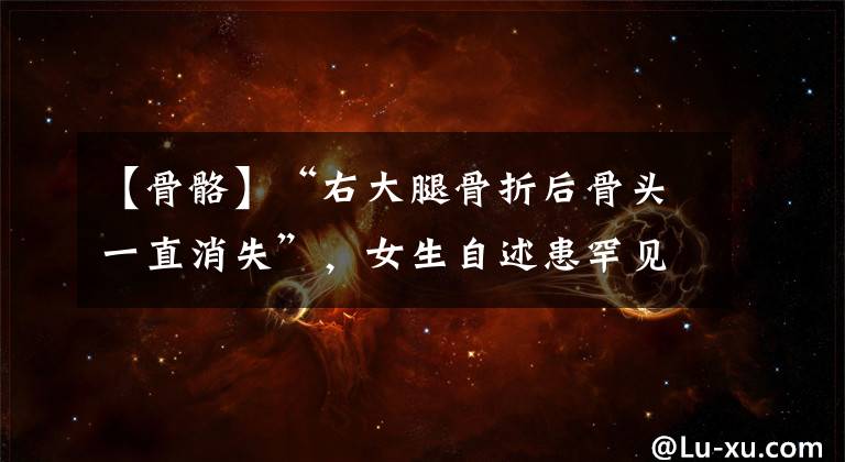 【骨骼】“右大腿骨折后骨头一直消失”，女生自述患罕见病多年无法找到病因