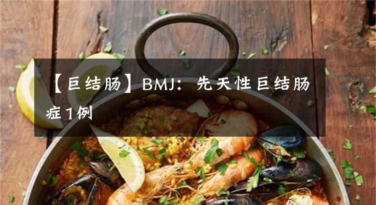 【巨结肠】BMJ：先天性巨结肠症1例