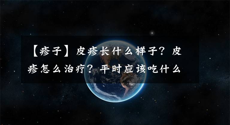 【疹子】皮疹长什么样子？皮疹怎么治疗？平时应该吃什么？