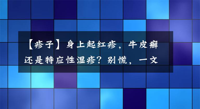 【疹子】身上起红疹，牛皮癣还是特应性湿疹？别慌，一文帮你分清