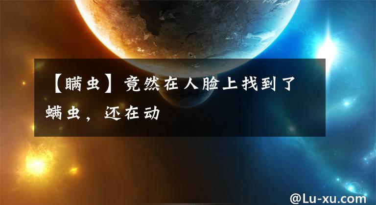 【瞒虫】竟然在人脸上找到了螨虫，还在动