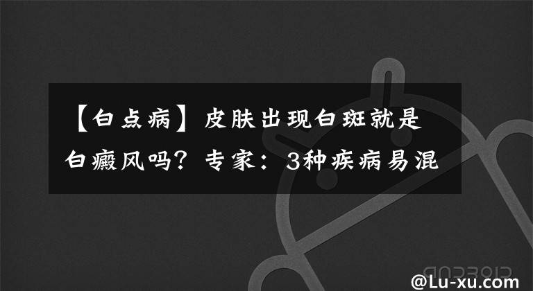 【白点病】皮肤出现白斑就是白癜风吗？专家：3种疾病易混淆