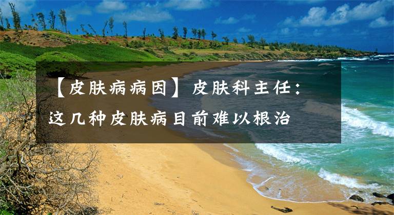 【皮肤病病因】皮肤科主任：这几种皮肤病目前难以根治