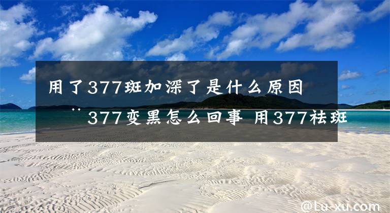 用了377斑加深了是什么原因 用377变黑怎么回事 用377祛斑有没有返黑期