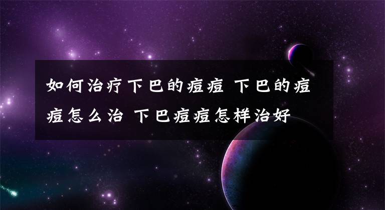 如何治疗下巴的痘痘 下巴的痘痘怎么治 下巴痘痘怎样治好