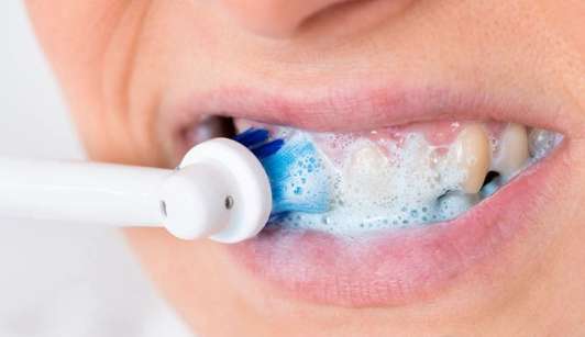 洁牙粉 多久洁牙一次合适 洁牙粉多久使用一次