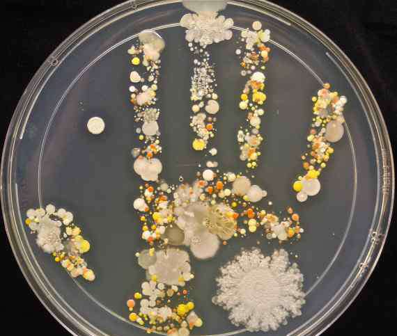 儿童手上细菌图片 图文：孩子的小手上有多少细菌？