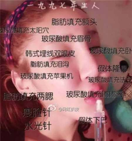 桃花宝宝李美人的资料 桃花宝宝是男的女的  桃花宝宝整容对比