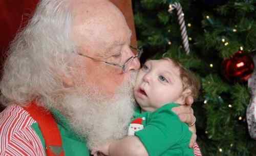 无脑婴儿 美无脑婴儿将迎第一个圣诞节 与圣诞老人拍照